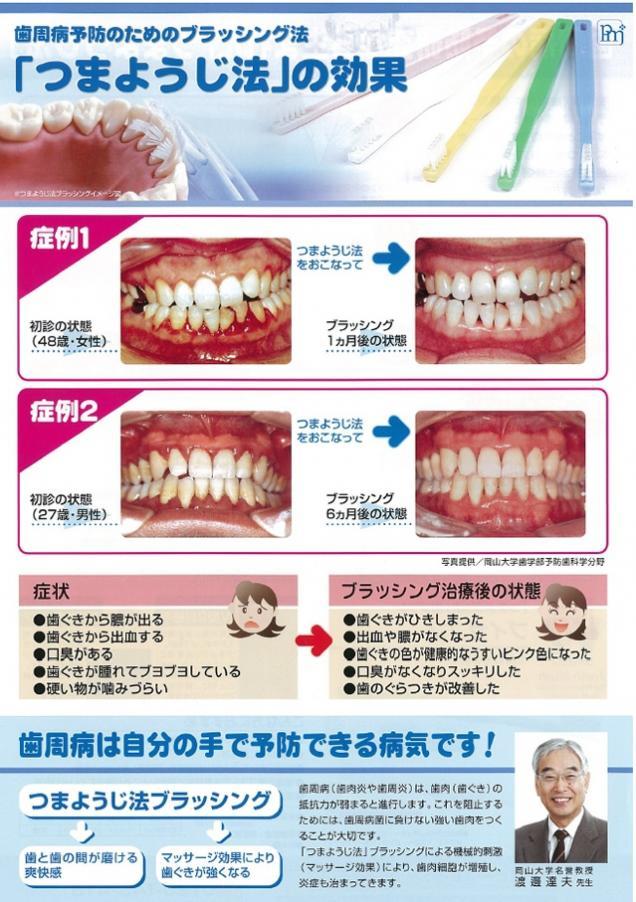 つまようじ法01