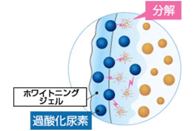 ホワイトニングによる色素の分解